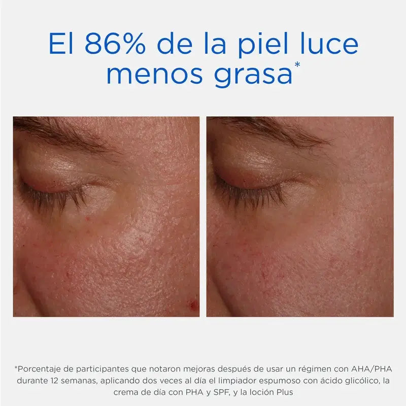 Neostrata Resurface Forte Loção Esfoliante Hidratante 15% AHA, 200 ml