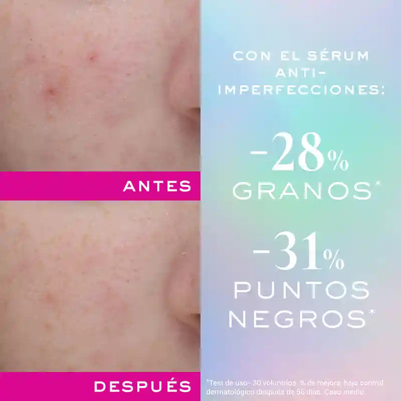 Nuxe Zinc Power Sérum Anti-Perfeições , 30 ml