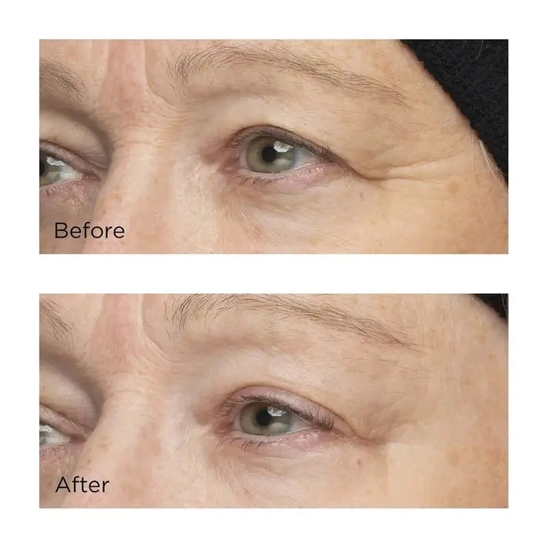 Perricone Cold Plasma Plus+ O Complexo Hidratante Intensivo, 59 ml