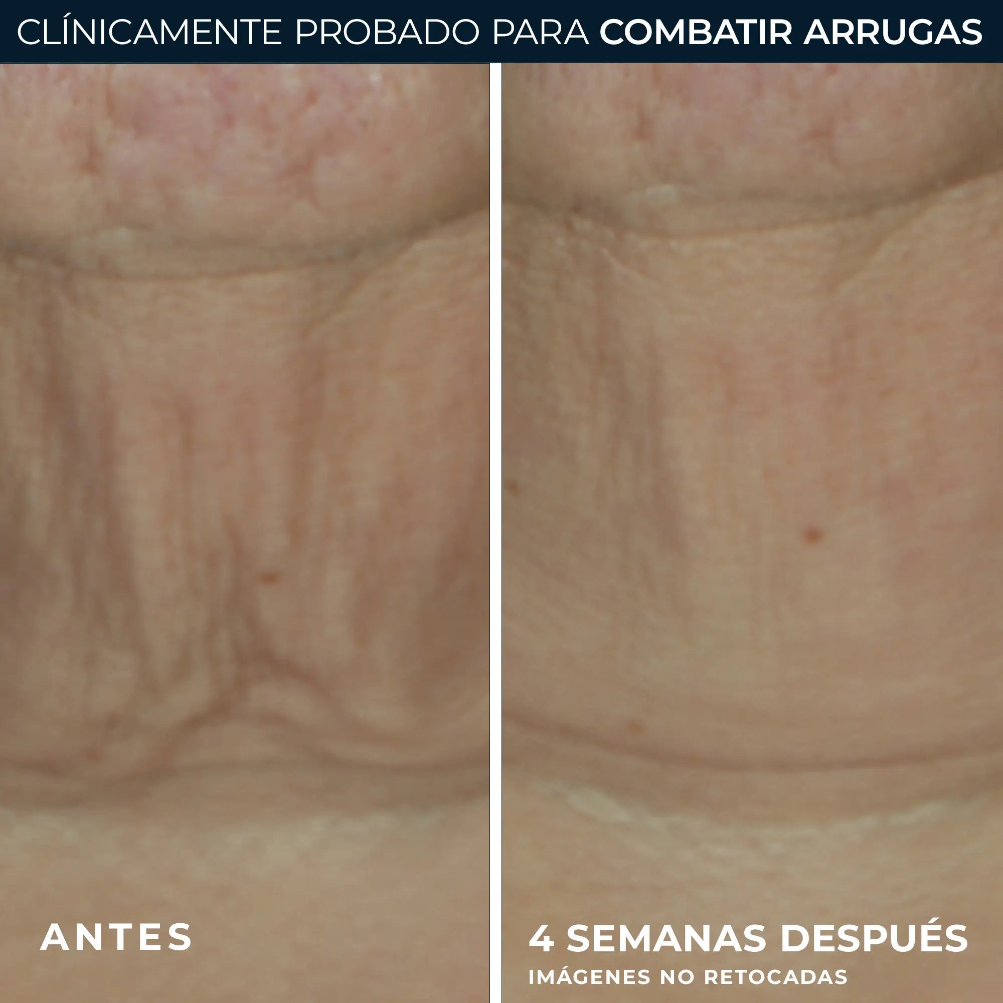Roc Skincare Iberia Roc® Derm Correxion® Stick Refirmante 30G