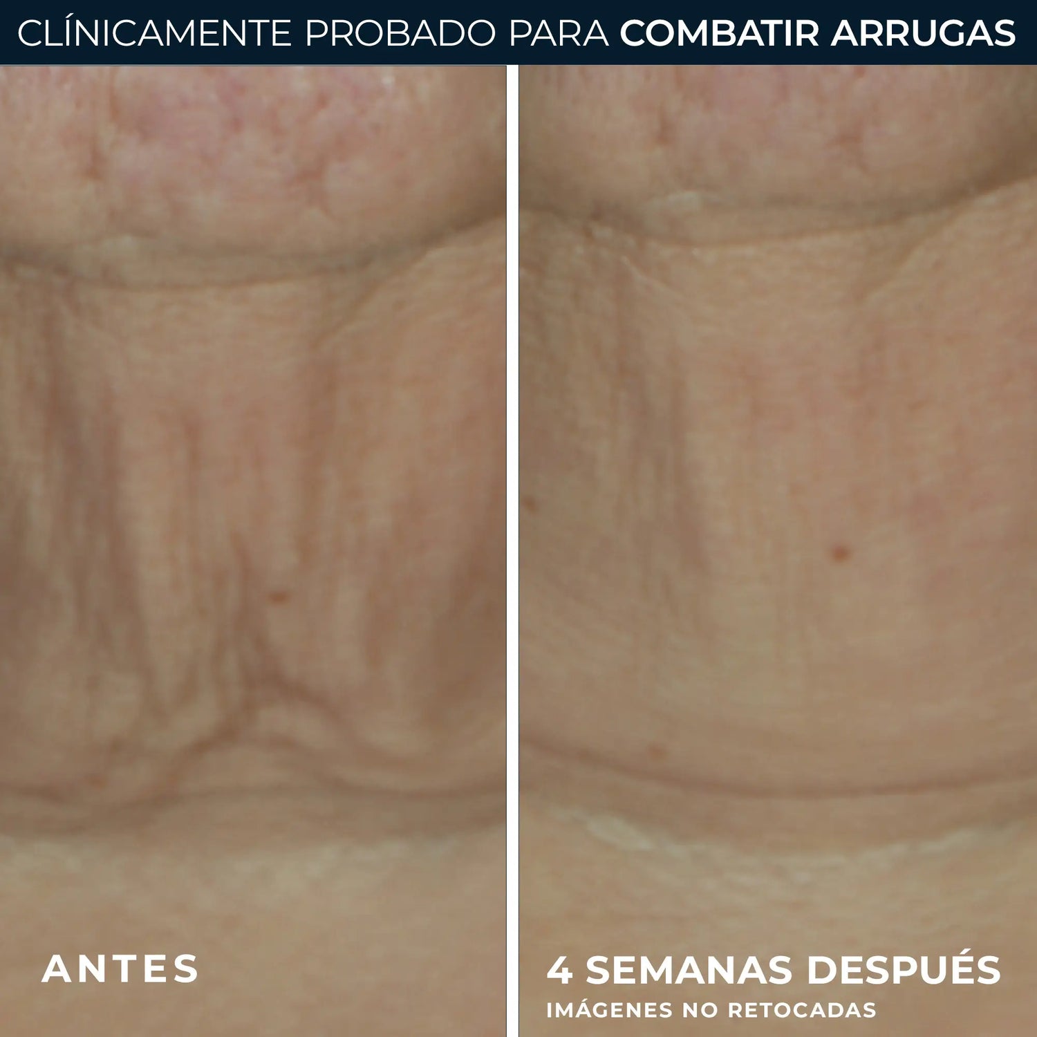 Roc Skincare Iberia Roc® Derm Correxion® Stick Refirmante 30G