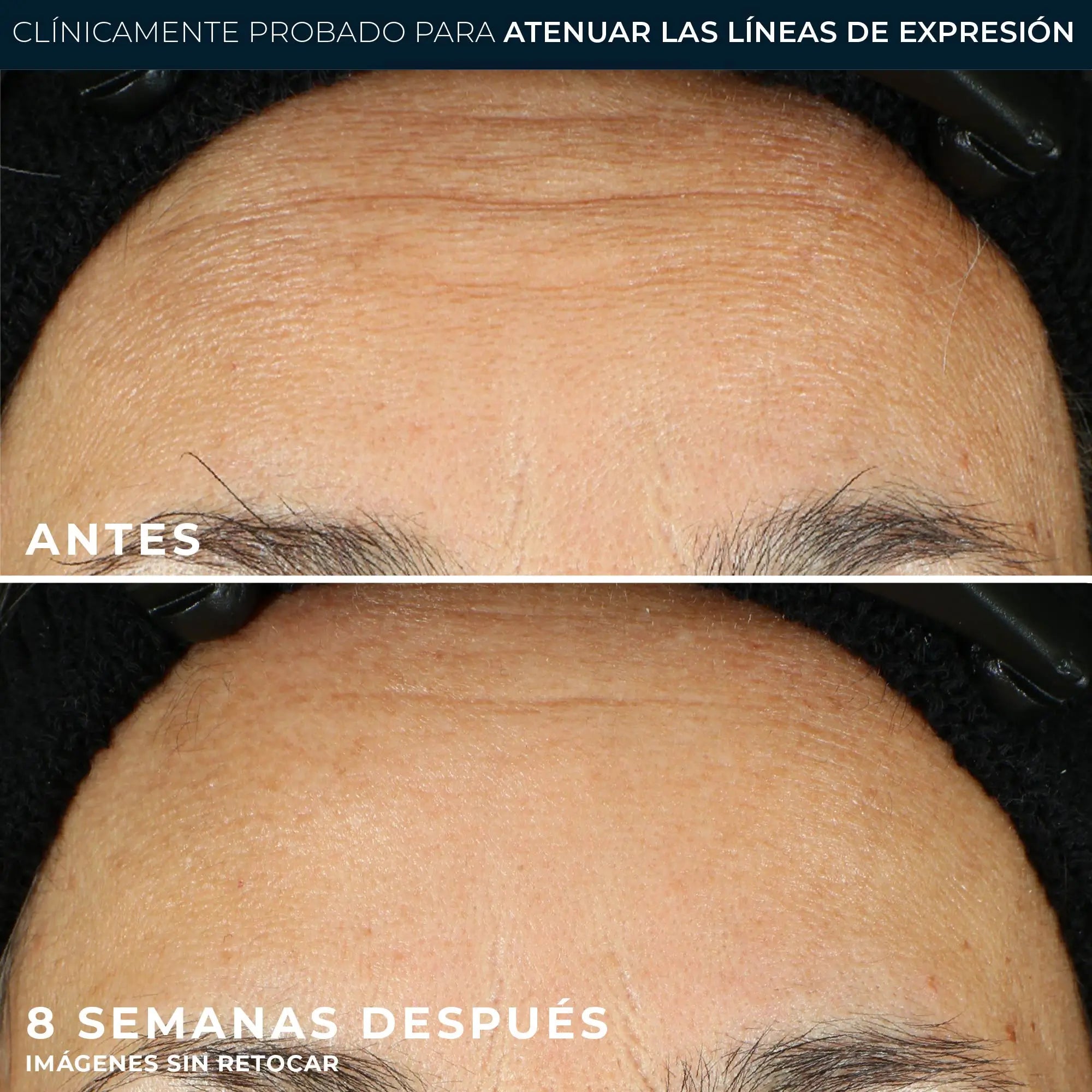 Roc Skincare Iberia Roc® Line Smoothing Serum Em Cápsulas 30Uds