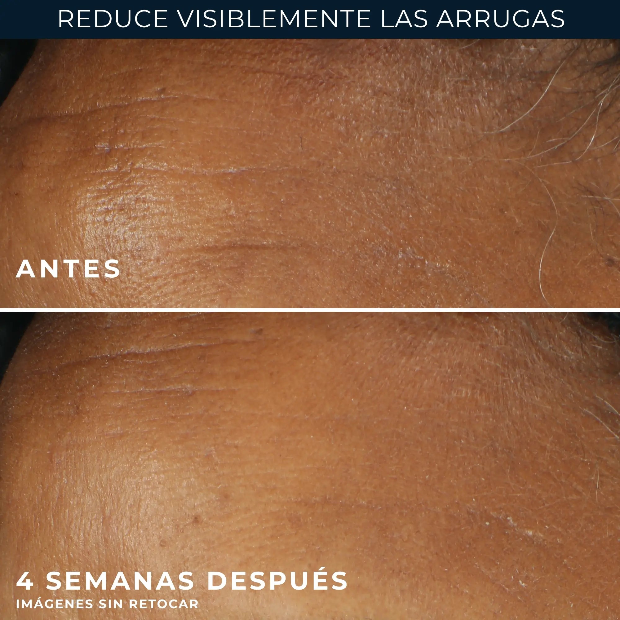 Roc Skincare Iberia Roc® Creme de Dia Corretor de Rugas Spf30 30Ml