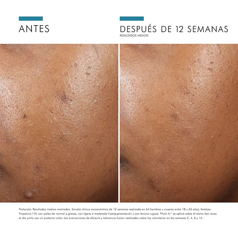 SkinCeuticals Phyto A+ Brigando Tratamento, 30ml