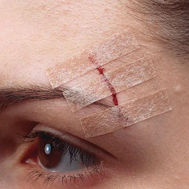 3M Sutura Adesiva Steri-Strip 75 x 6 mm 3 tiras