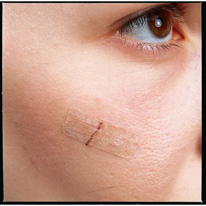 3M Sutura Adesiva Steri-Strip 75 x 6 mm 3 tiras