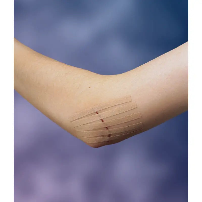 3M Sutura Adesiva Steri-Strip 75 x 6 mm 3 tiras