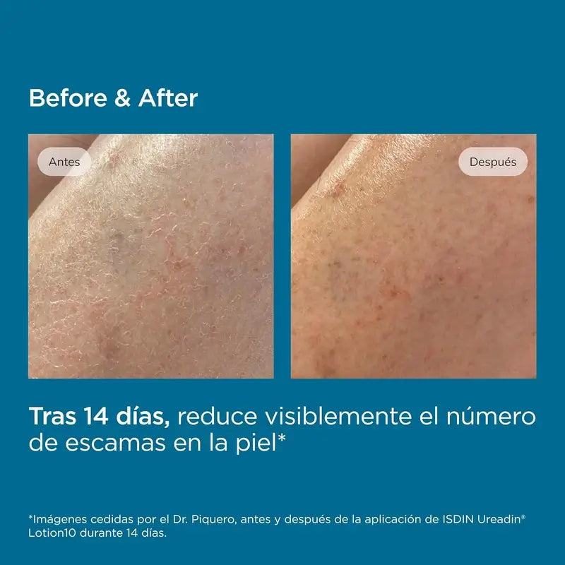 Isdin Ureadin Loção 1000 Ml