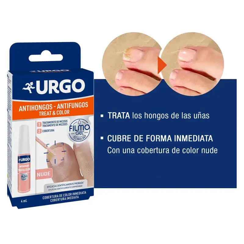 Urgo - Anti-fungal Treat & Colour Filmogel - Frasco de 4 ml