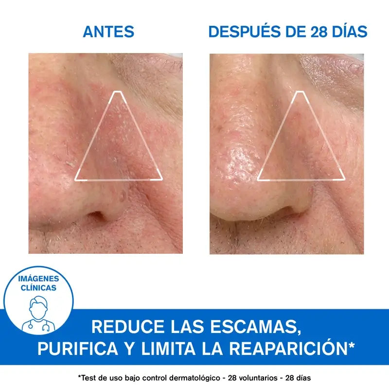 Uriage Ds Emulsão Suavizante 40Ml Sem perfume